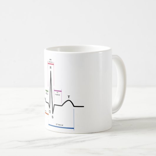TASSE Sinus Rhythmus EKG-Diagramm (VorderseiteRechts)