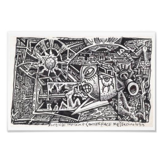 Technologie für chirurgisches Implantat (Interface Fotodruck (Vorne)