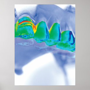 Teeth Design Zahnarzt Orthodontist Poster