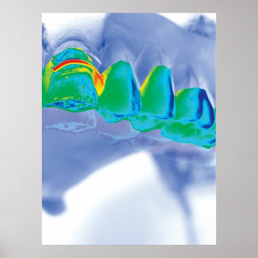 Teeth Design Zahnarzt Orthodontist Poster (Vorne)