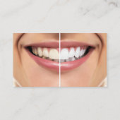 Terminkarten für Zahnschmerzen Whitening Visitenkarte (Rückseite)