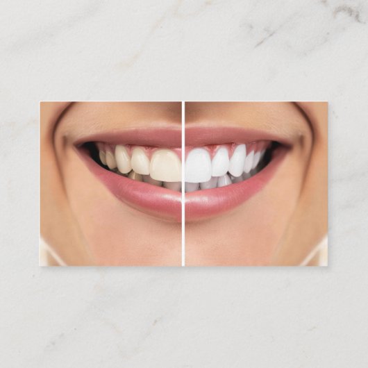 Terminkarten für Zahnschmerzen Whitening Visitenkarte (Rückseite)