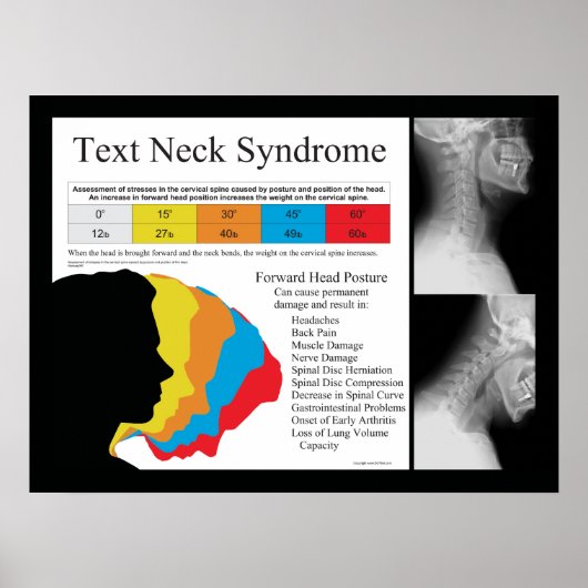 Text Neck Syndrom Chiropraktisches Poster (Vorne)