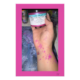 The Hand That Micas Fotodruck