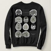 Thisiswhat depressionlook_FULLCTScan Sweatshirt (Design Rückseite)