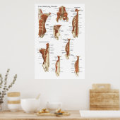 Tief stabilisierende Muskeln Anatomie Poster (Küche)