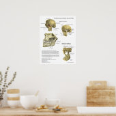 TMJ Joint Syndrome Anatomy Medical Poster (Küche)