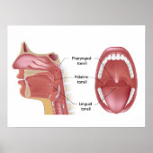 Tonsils Poster (Vorne)