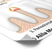 Tooth Periodontal Disease Poster (Ecke)