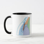 Trabeculectomy Verfahren Tasse (Links)