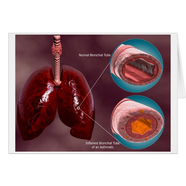 Trachea Kreuzabschnitt mit Lungen (Vorderseite (Horizontal))