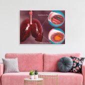 Trachea Kreuzabschnitt mit Lungen Leinwanddruck (Insitu (Wohnzimmer))