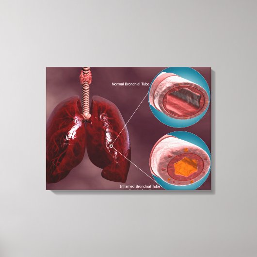 Trachea Kreuzabschnitt mit Lungen Leinwanddruck (Vorderseite)