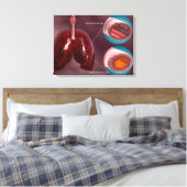 Trachea Kreuzabschnitt mit Lungen Leinwanddruck (Insitu (Schlafzimmer))