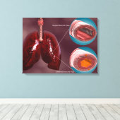 Trachea Kreuzabschnitt mit Lungen Leinwanddruck (Insitu (Holzboden))