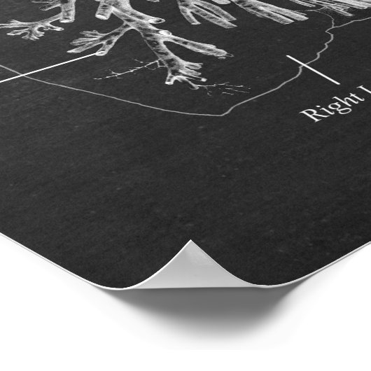 Trachea und Bronchi der Lungenanatomie Art Deco Poster (Ecke)