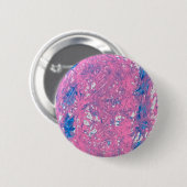 Transgender Marmorkunst Button (Vorne & Hinten)