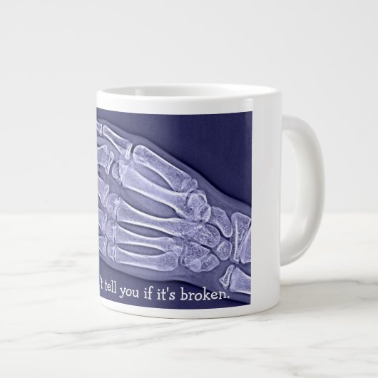 "Traurig, kann ich Ihnen nicht sagen, wenn es hat Jumbo-Tasse (Vorderseite Rechts)