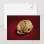 Trepanned Skull Postkarte (Vorne/Hinten)