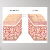 Trockenes Hautpflaster Poster (Vorne)