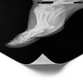 Trump Bone Spur Ink Pen Funny Anti Trump  Poster (Ecke)