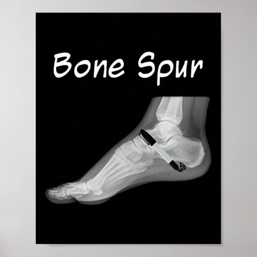 Trump Bone Spur Ink Pen Funny Anti Trump  Poster (Vorne)