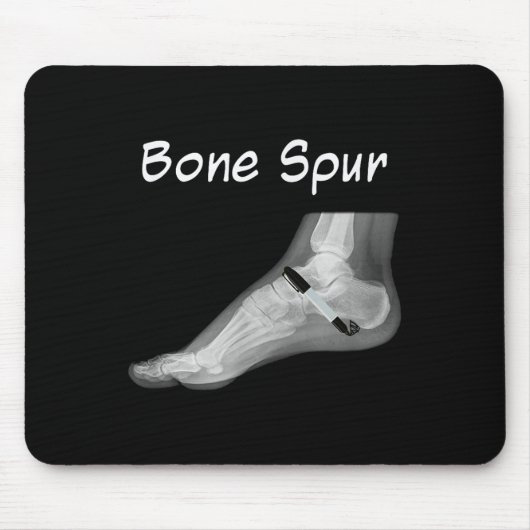 Trump Knochenspur Tink Pen Funny Anti Trump Mousepad (Vorne)