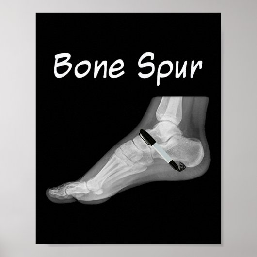 Trump Knochenspur Tink Pen Funny Anti Trump Poster (Vorne)