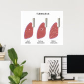 Tuberkulose Poster (Heimbüro)