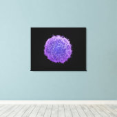 Tumorzelle der menschlichen Haut Leinwanddruck (Insitu (Holzboden))