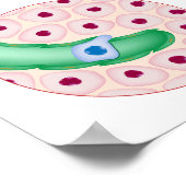 Tumorzellmetastase Poster (Ecke)