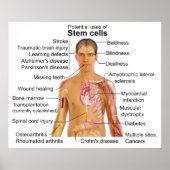 Übersicht über den möglichen Nutzen für die Behand Poster (Vorne)