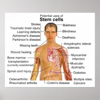 Übersicht über den möglichen Nutzen für die Behand Poster