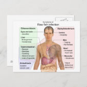 Übersicht über die Symptome einer Infektion mit ro Postkarte (Vorne/Hinten)