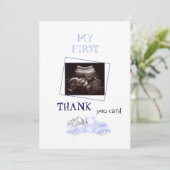 Ultraschall dank Babysicht Dankeskarte (Stehend Vorderseite)