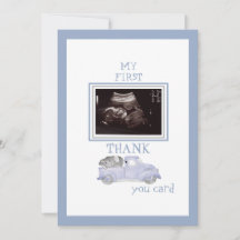 Ultraschall-Foto-LKW dankt blauem Baby-Blickwinkel