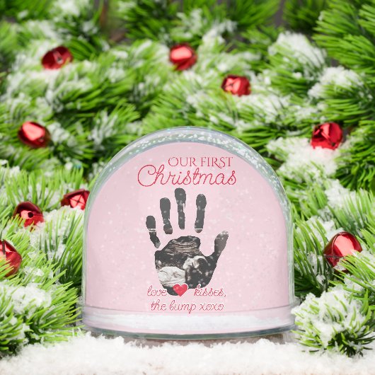 Ultrasound 1st Christmas Pregnancy Announcement Schneekugeln (Weihnachten)