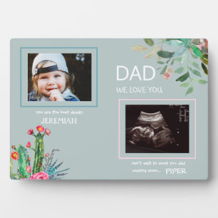 Ultrasound 2 fotoplatte