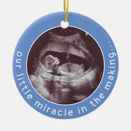 Ultrasound Foto Baby Boy Blue Wunder Making I Keramik Ornament (Vorne)