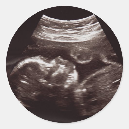 Ultrasound Foto Babydusche Danke Siegel Runder Aufkleber (Vorderseite)