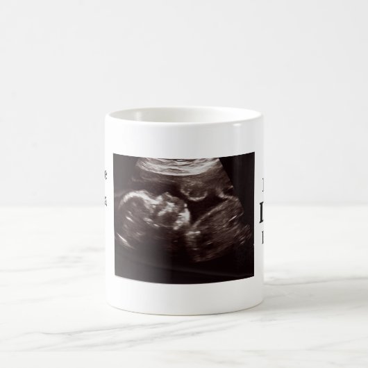 Ultrasound Foto Pater wird der beste Vater aller Z Kaffeetasse (Mittel)