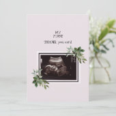 Ultrasound Foto Pink Baby Point Dankeskarte (Stehend Vorderseite)