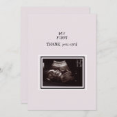 Ultrasound Foto Pink Danke Baby (Vorne/Hinten)