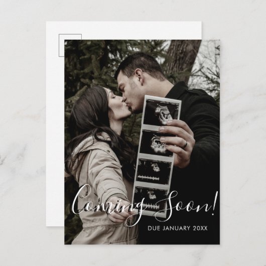 Ultrasound Foto Skript kommt bald Schwangerschaft Ankündigungspostkarte (Vorne/Hinten)