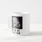 Ultrasound Foto Vater zum Kaffee Tasse (Vorderseite Links)