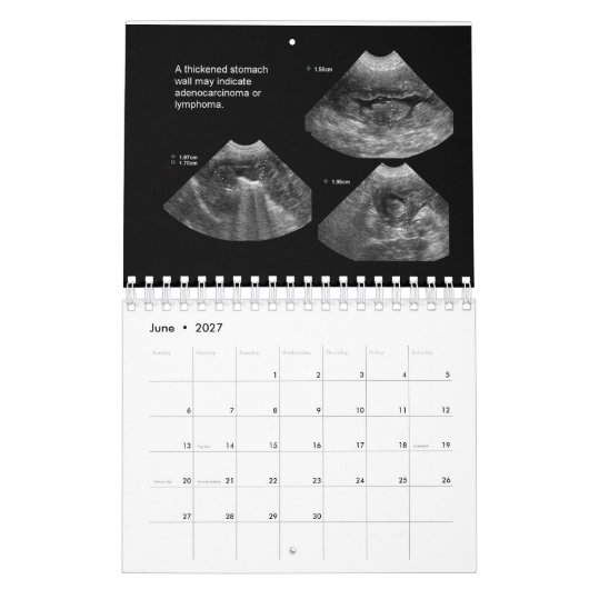 Ultrasound Kalender (Jun 2027)