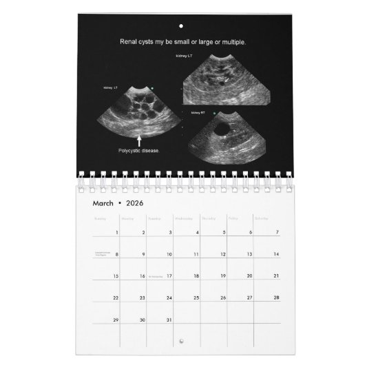 Ultrasound Kalender (Mär 2026)