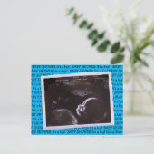 Ultrasound Picture Baby Dusche Einladung Postkarte (Stehend Vorderseite)