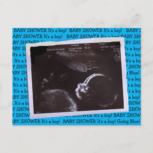 Ultrasound Picture Baby Dusche Einladung Postkarte (Vorderseite)