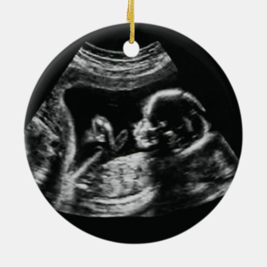 Ultrasound Schwangerschaft Ankündigung Weihnachten Keramik Ornament (Hinten)